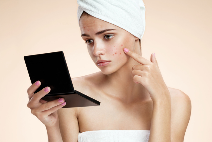 Are These Healthy Foods Causing Your Breakouts? 5 Healthy Foods That Can Cause Acne and Why